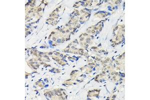 Immunohistochemistry (IHC) image for anti-Sjogren Syndrome Nuclear Autoantigen 1 (SSNA1) (AA 1-119) antibody (ABIN6148483)