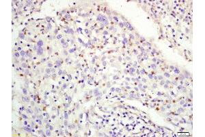 Immunohistochemistry (Paraffin-embedded Sections) (IHC (p)) image for anti-Replication Factor C (Activator 1) 1, 145kDa (RFC1) (AA 401-500) antibody (ABIN1387575)