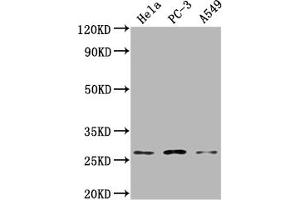 Western Blot Positive WB detected in: Hela whole cell lysate, PC-3 whole cell lysate, A549 whole cell lysate All lanes: RAB23 antibody at 1:2000 Secondary Goat polyclonal to rabbit IgG at 1/50000 dilution Predicted band size: 27 kDa Observed band size: 27 kDa (RAB23 antibody  (AA 18-234))