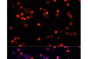Immunofluorescence analysis of HeLa cells using AKT2 Polyclonal Antibody at dilution of 1:100. (AKT2 antibody)