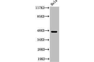 Western Blot analysis of HeLa cells using Cleaved-Plasma Kallikrein HC (R390) Polyclonal Antibody (KLKB1 antibody  (Cleaved-Arg390))