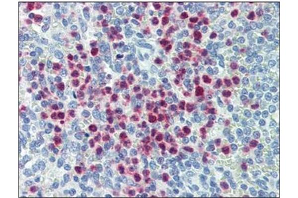 MYADM antibody