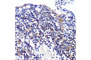 Immunohistochemistry (IHC) image for anti-SWAP Switching B-Cell Complex 70kDa Subunit (SWAP70) (AA 316-585) antibody (ABIN7270654)