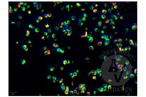 Multiplex Immunohistochemistry (mIHC) image for anti-SARS-Coronavirus Nucleocapsid Protein (SARS-CoV N) antibody (ABIN6952544)