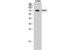 Western Blot (WB) analysis of Jurkat cells using DMPK Polyclonal Antibody. (DMPK antibody  (N-Term))