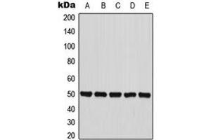 Western blot analysis of PANK2 expression in HepG2 (A), MCF7 (B), HT29 (C), mouse liver (D), PC12 (E) whole cell lysates.