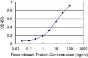 Detection limit for recombinant GST tagged ULK2 is 0. (ULK2 antibody  (AA 743-843))