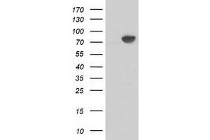 HEK293T cells were transfected with the pCMV6-ENTRY control (Left lane) or pCMV6-ENTRY CTNNB1 (Right lane) cDNA for 48 hrs and lysed. (CTNNB1 antibody)