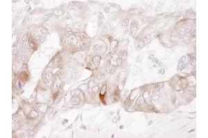 Immunohistochemistry (IHC) image for anti-Mast/stem Cell Growth Factor Receptor (KIT) (AA 925-976) antibody (ABIN7454909)
