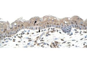 Human Skin (RNF25 antibody  (Middle Region))