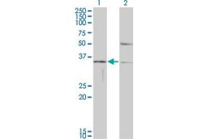 Western Blot analysis of HAVCR1 expression in transfected 293T cell line by HAVCR1 monoclonal antibody (M01), clone 1E5. (HAVCR1 antibody  (AA 23-122))