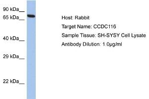 Host: Rabbit Target Name: CCDC116 Sample Tissue: Human SH-SYSY Whole Cell  Antibody Dilution: 1ug/ml (CCDC116 antibody  (C-Term))