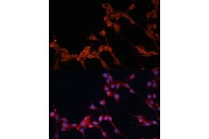 Immunofluorescence analysis of NIH/3T3 cells using SLC25 antibody (ABIN6128769, ABIN6147928, ABIN6147929 and ABIN6217136) at dilution of 1:100. (SLC25A38 antibody  (AA 140-220))