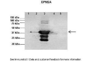 Western Blotting (WB) image for anti-Epilepsy, Progressive Myoclonus Type 2A, Lafora Disease (Laforin) (EPM2A) (N-Term) antibody (ABIN2789472) (EPM2A antibody  (N-Term))