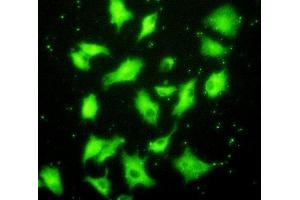 Detection of XRCC6 in A549 cells using Polyclonal Antibody to X-Ray Repair Cross Complementing 6 (XRCC6) (XRCC6 antibody  (AA 397-603))