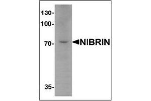 Western blot analysis of NIBRIN in mouse lung tissue lysate with NIBRIN antibody (C-term) Cat. (Nibrin antibody  (C-Term))