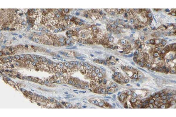 RABL5 antibody  (Internal Region)