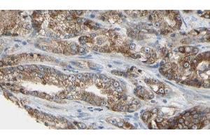 ABIN6279709 at 1/100 staining Human prostate tissue by IHC-P. (RABL5 antibody  (Internal Region))
