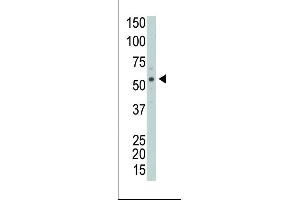 The anti-PRKCABP Pab (ABIN391108 and ABIN2841239) is used in Western blot to detect PRKCABP in Y79 cell lysate. (PICK1 antibody  (N-Term))