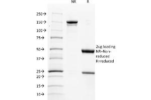 SDS-PAGE Analysis Purified CD137L-Monospecific Mouse Monoclonal Antibody (CD137L/1547). (TNFSF9 antibody)