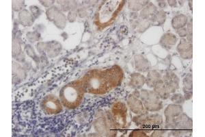 Immunostaining (ISt) image for anti-Calcium Responsive Transcription Factor (CARF) (AA 621-718) antibody (ABIN566385)
