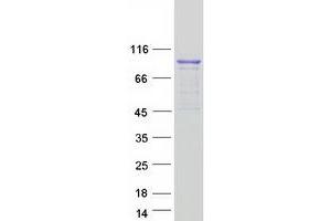 Western Blotting (WB) image for DEAH (Asp-Glu-Ala-His) Box Polypeptide 15 (DHX15) protein (Myc-DYKDDDDK Tag) (ABIN2719457)