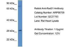 Western Blotting (WB) image for anti-RAD21 Homolog (RAD21) (N-Term) antibody (ABIN2786857) (RAD21 antibody  (N-Term))