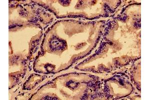 Immunohistochemistry of paraffin-embedded human prostate tissue using ABIN7164874 at dilution of 1:100 (PTGDS antibody  (AA 23-190))
