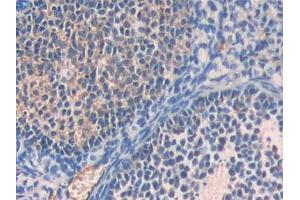 DAB staining on IHC-P; Samples: Mouse Ovary Tissue (Fetuin A antibody  (AA 19-250))
