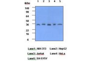 Image no. 1 for anti-C-Reactive Protein (CRP) (AA 19-224) antibody (ABIN377183) (CRP antibody  (AA 19-224))