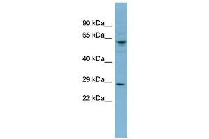 DERL3 antibody used at 1 ug/ml to detect target protein. (Derlin-3 antibody  (Middle Region))