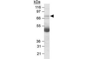 Western blot analysis of NOX4 in human kidney lysates with NOX4 polyclonal antibody at 2.