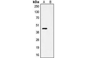 Western blot analysis of Anti-V5-tag Antibody against HEK293T cells transfected with vector overexpressing V5 tag (A) and untransfected (B). (V5 Epitope Tag antibody)