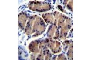 Immunohistochemistry analysis in formalin fixed and paraffin embedded human stomach tissue reacted with LIPC / Hepatic lipase (Center) followed by peroxidase conjugation of the secondary antibody and DAB staining. (LIPC antibody  (Middle Region))