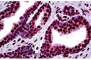 Human Prostate: Formalin-Fixed, Paraffin-Embedded (FFPE) (MEF2A antibody  (AA 71-170))