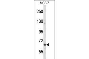 Western blot analysis of P2 Antibody  in MCF-7 cell line lysates (35 μg/lane). (MAP2 antibody)