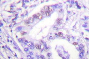 Image no. 1 for anti-Protein Inhibitor of Activated STAT, 4 (PIAS4) antibody (ABIN271954) (PIAS4 antibody)