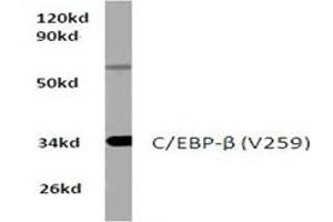 Image no. 1 for anti-CCAAT/enhancer Binding Protein (C/EBP), beta (CEBPB) antibody (ABIN272175) (CEBPB antibody)