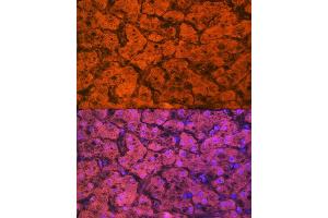 Immunofluorescence analysis of human liver using Hemopexin (HPX) (HPX) Rabbit mAb (ABIN7267611) at dilution of 1:100 (40x lens). (Hemopexin antibody)