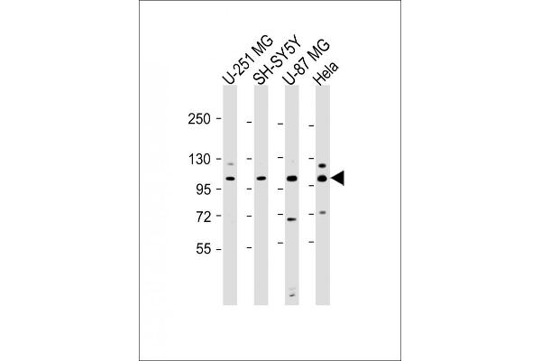 SH3PXD2B antibody  (AA 505-539)