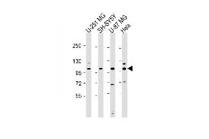 SH3PXD2B anticorps  (AA 505-539)
