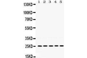 Western Blotting (WB) image for anti-Progesterone Receptor Membrane Component 1 (PGRMC1) (AA 67-102), (Middle Region) antibody (ABIN3043899) (PGRMC1 antibody  (Middle Region))