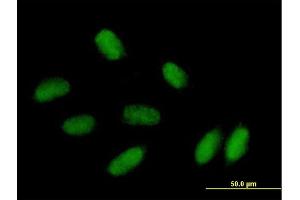 Immunofluorescence of purified MaxPab antibody to PRRX1 on HepG2 cell. (PRRX1 antibody  (AA 1-217))