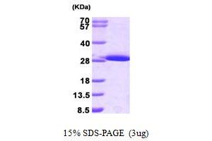 SDS-PAGE (SDS) image for Glutathione S-Transferase mu 1 (GSTM1) (AA 1-218) protein (His tag) (ABIN666904)