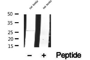 Western blot analysis of extracts of rat testis tissue, using DCTN6 antibody. (DCTN6 antibody  (Internal Region))