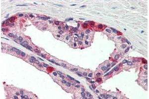 Human Prostate (formalin-fixed, paraffin-embedded) stained with TAOK3 antibody ABIN337220 at 1:5 followed by biotinylated anti-goat IgG secondary antibody ABIN481715, alkaline phosphatase-streptavidin and chromogen. (TAO Kinase 3 antibody  (AA 396-411))