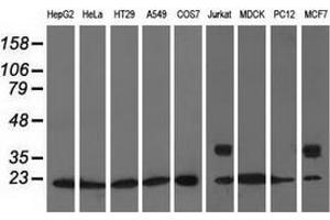 Western blot analysis of extracts (35 µg) from 9 different cell lines by using anti-ARHGDIA monoclonal antibody. (ARHGDIA antibody)