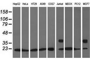 Western blot analysis of extracts (35 µg) from 9 different cell lines by using anti-ARHGDIA monoclonal antibody. (ARHGDIA antibody)