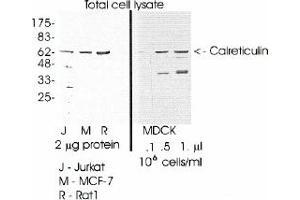 Image no. 1 for anti-Calreticulin (CALR) (C-Term) antibody (ABIN265295) (Calreticulin antibody  (C-Term))