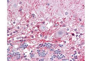Anti-RP2 antibody IHC of human brain, cerebellum. (RP2 antibody  (C-Term))